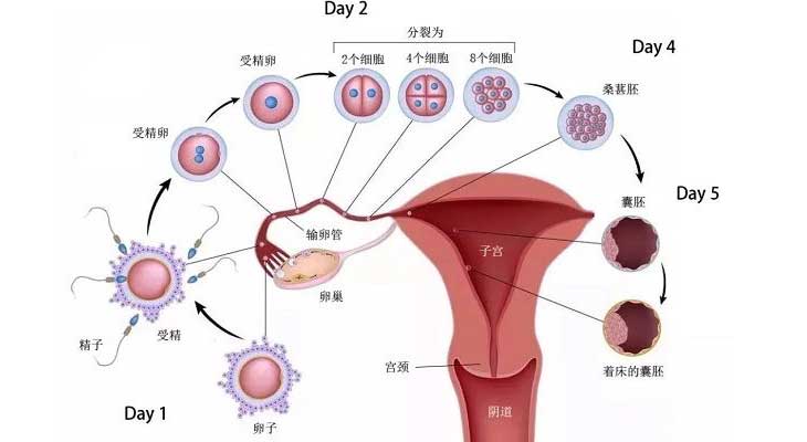 受精卵从输卵管到子宫着床示意图